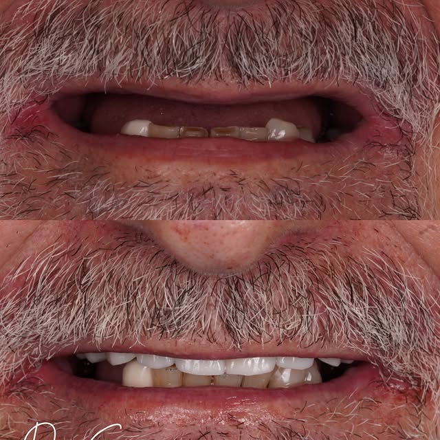 Function and esthetics from Dr. Sran's Instagram