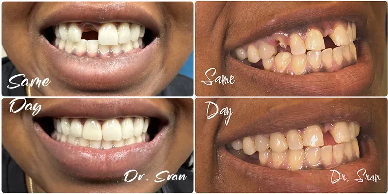 Emergency Tooth Pain at Astra Dental in Stratford, CT
